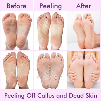 SilkySoles™ Exfoliating Foot Peel Mask
